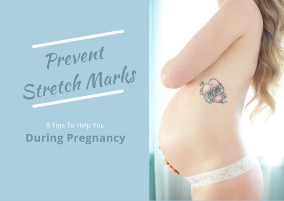 8 Tips To Help You Prevent Stretch Marks During Pregnancy